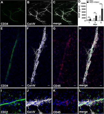 De novo Vessel Formation Through Cross-Talk of Blood-Derived Cells and Mesenchymal Stromal Cells in the Absence of Pre-existing Vascular Structures